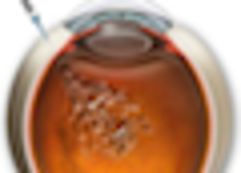 Офтальмологические инъекции в ЕМЦ