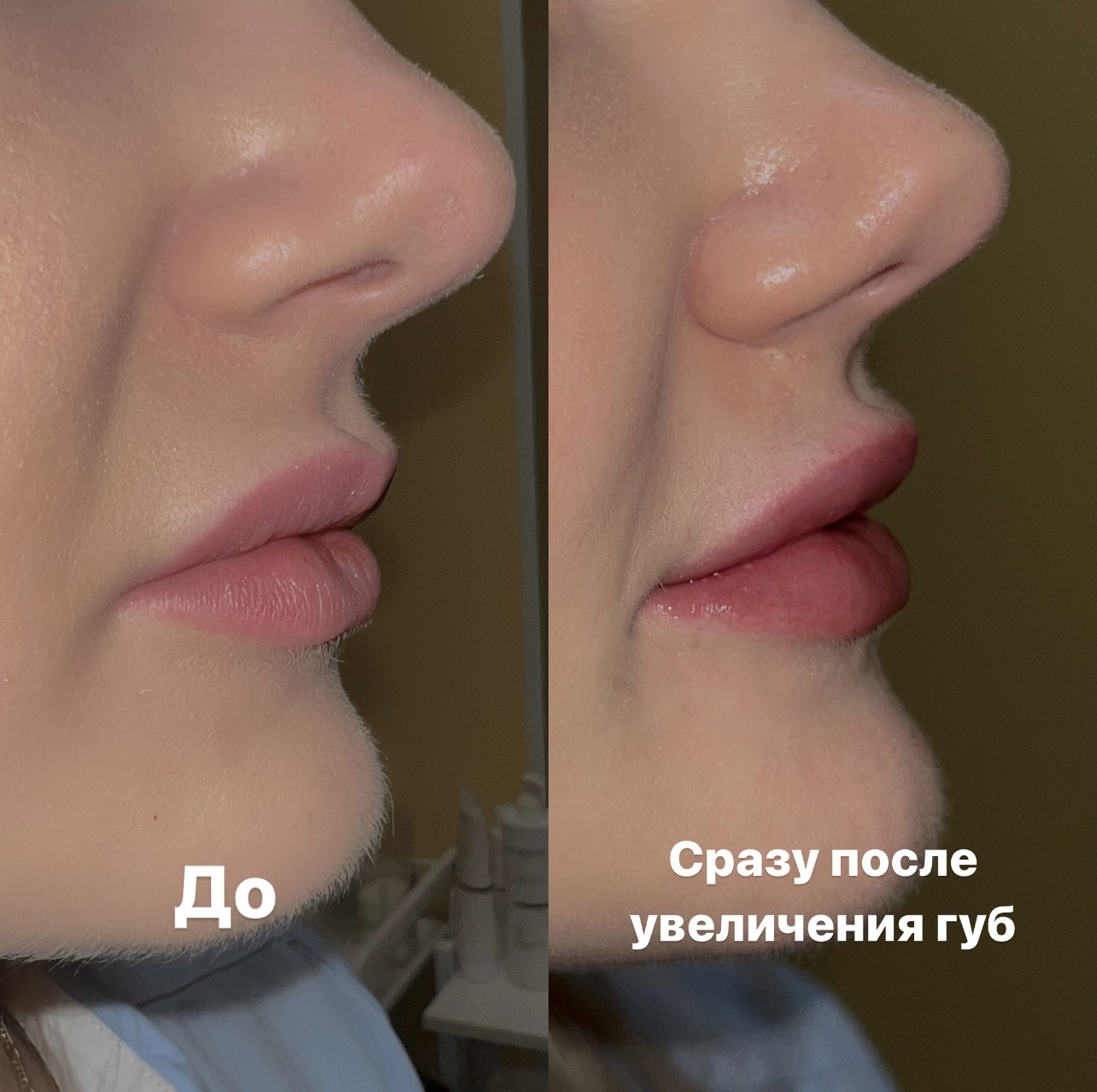 До 