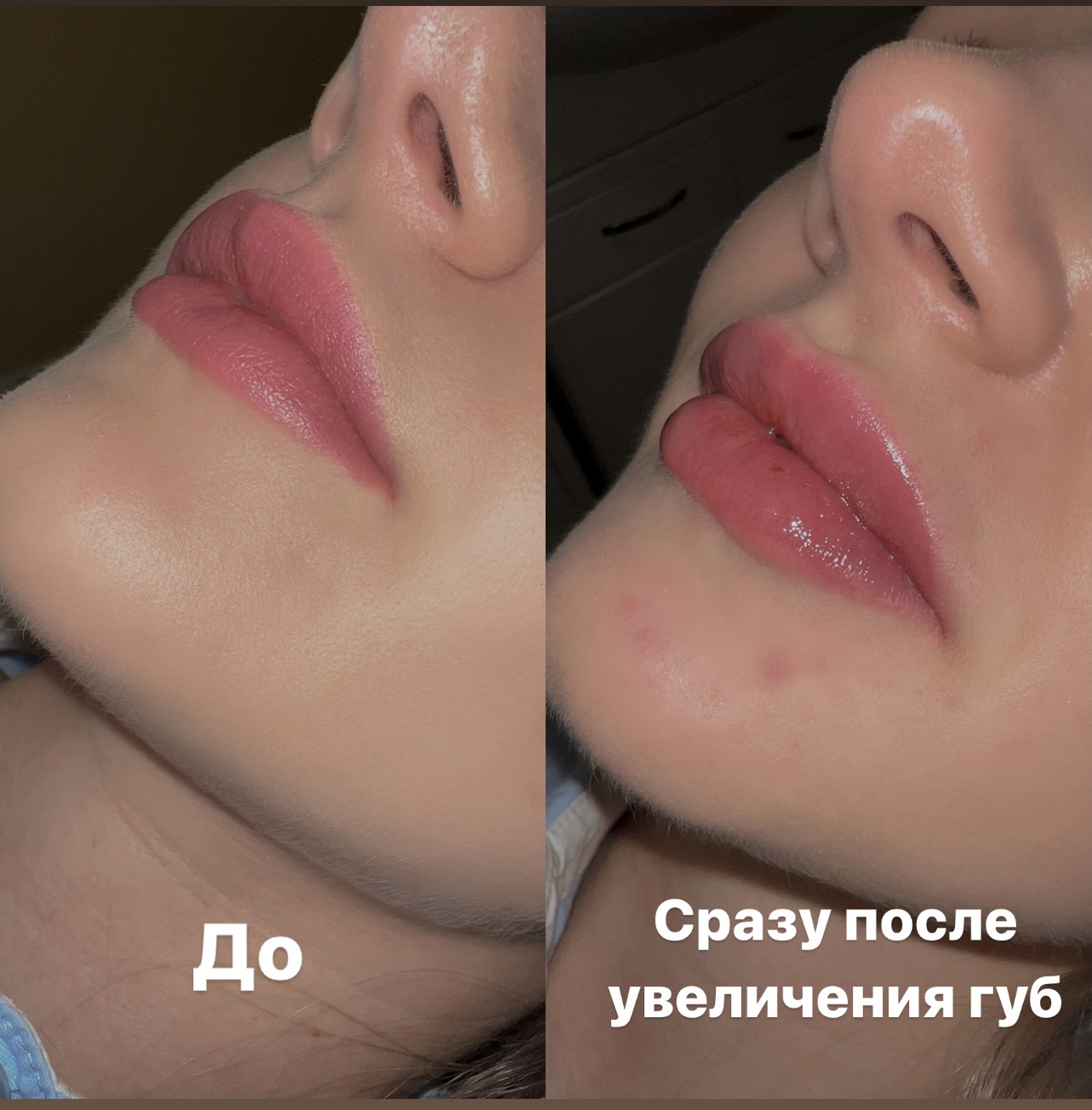 До 