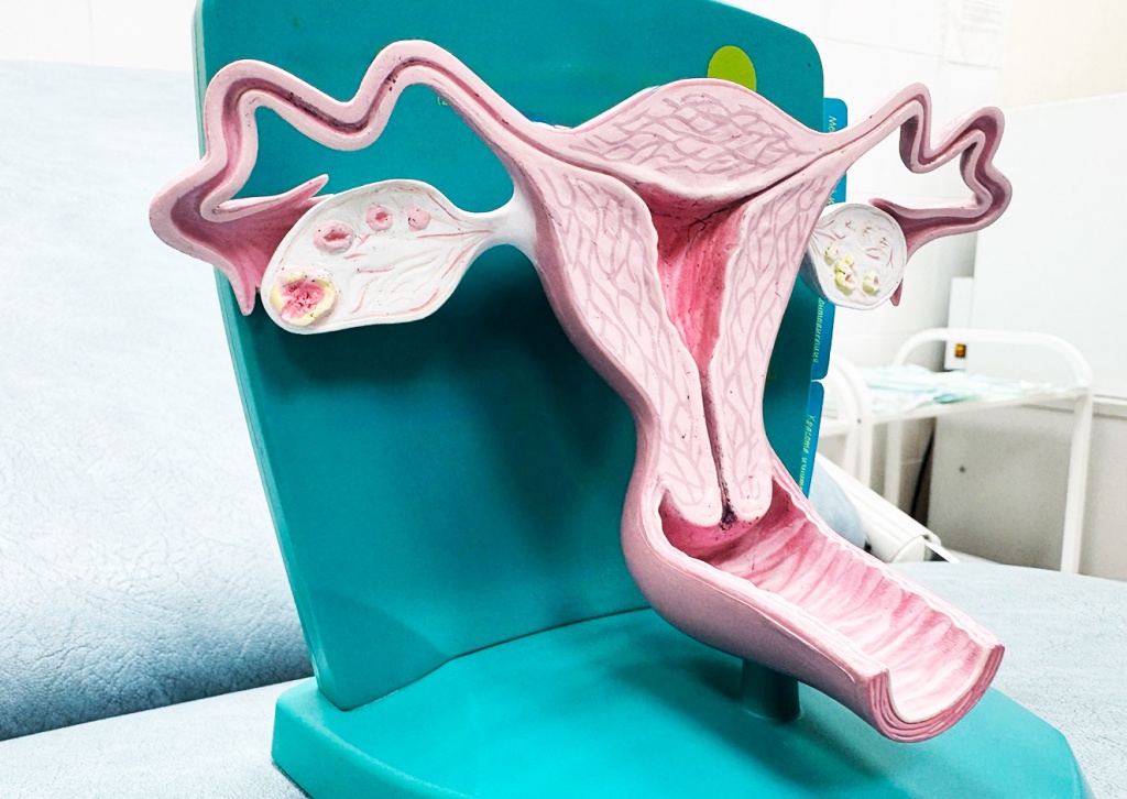 Программа "Свой гинеколог"