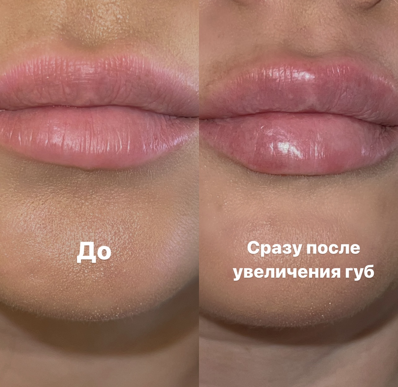 До 