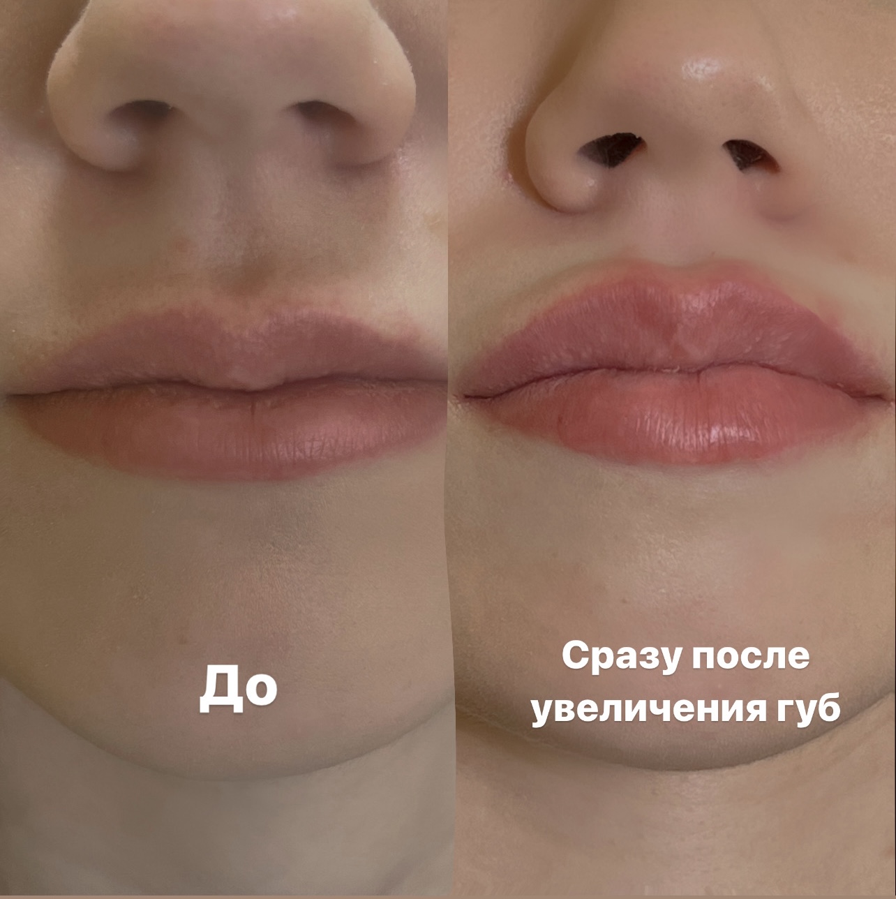 До 