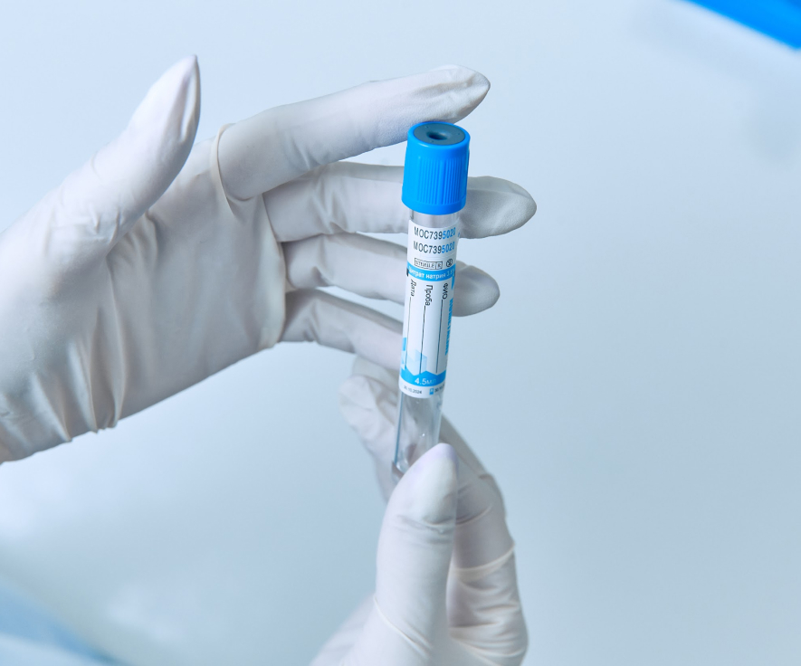 Вакцинация от клещевого энцефалита