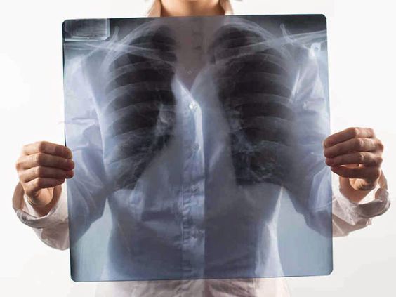 12 ноября - Всемирный день борьбы с пневмонией.jpg