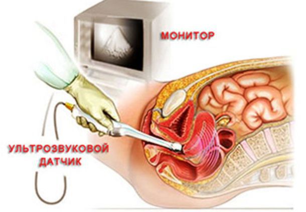 узи гинекологическое Екатеринбург цены