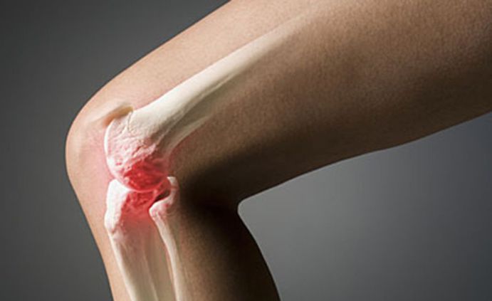 Методы диагностики заболеваний коленного сустава. Сравнительная характеристика.jpg