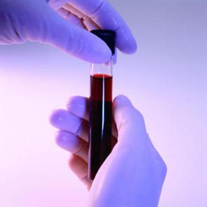 Марихуана анализ крови на гормоны браузер тора hydra2web