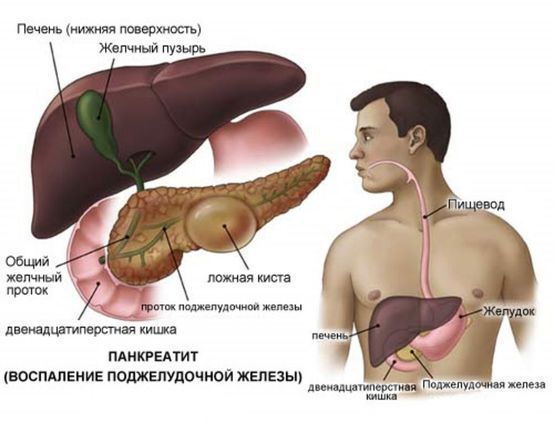 панкреатит.jpg