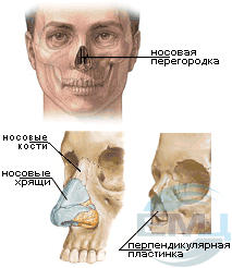 Деформация носовой перегородки.gif