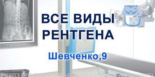 Все виды рентгена